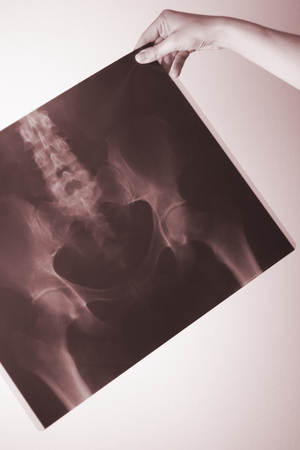 Medical hospital x-ray lowe back pain spine and hips traumatology scan.の写真素材