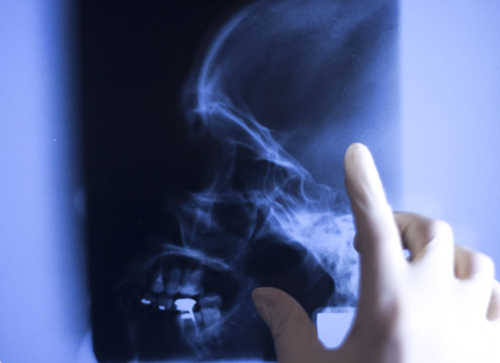 Medical hospital x-ray face skull mouth, teeth, nose and eyes scan.の写真素材