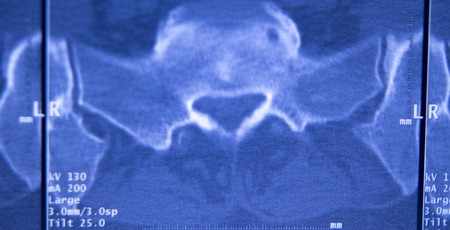 Medical hospital x-ray hips spine pelvis MRI traumatology scan.