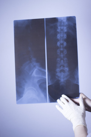 Medical hospital x-ray lowe back pain spine and hips traumatology scan.の写真素材