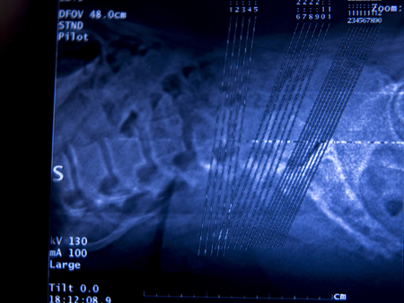 Medical hospital x-ray hips spine pelvis MRI traumatology scan.