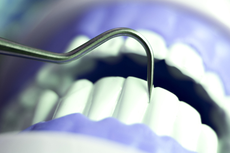 Dentist cleaning teeth with titanium metal tooth pick instrument to remove plaque and decay.の写真素材