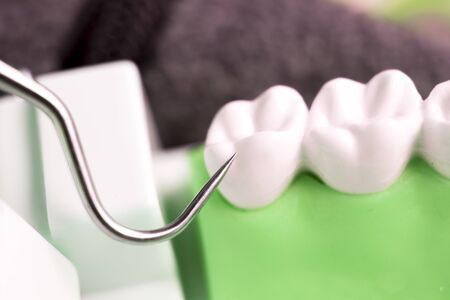 Dentist cleaning teeth with titanium metal tooth pick instrument to remove plaque and decay.