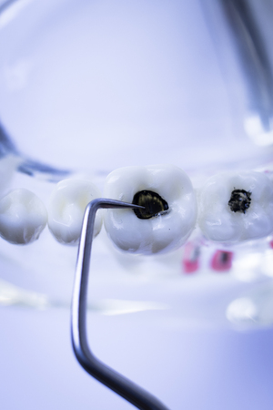 Dentist cleaning teeth with titanium metal tooth pick instrument to remove plaque and decay.の写真素材