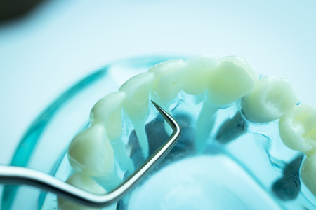 Dentist cleaning teeth with titanium metal tooth pick instrument to remove plaque and decay.の写真素材