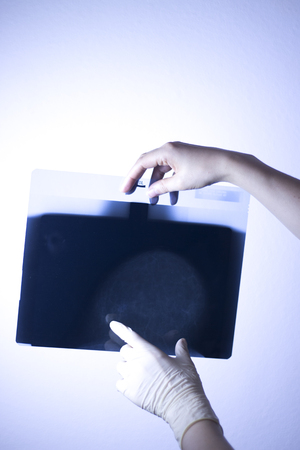 Medical hospital mammography x-ray breast cancer mammogram scan.の写真素材