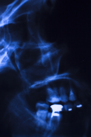 Medical hospital x-ray face skull mouth, teeth, nose and eyes scan.の写真素材