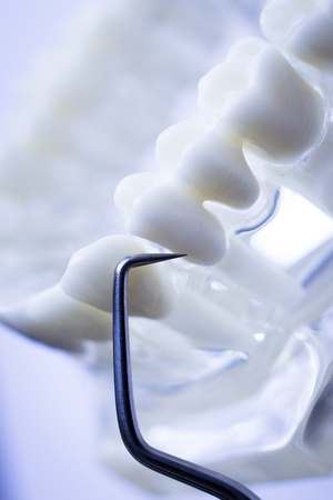 Dentist cleaning teeth with titanium metal tooth pick instrument to remove plaque and decay.の写真素材