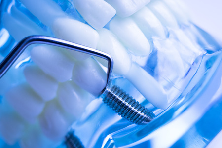 Dentist cleaning teeth with titanium metal tooth pick instrument to remove plaque and decay.