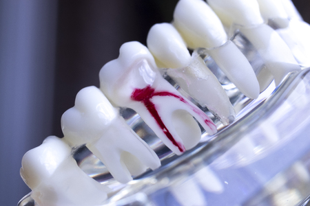 Dentist dental teeth teaching model showing each tooth and gum for patients and students.