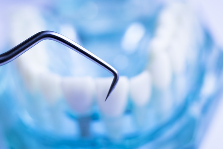 Dentist cleaning teeth with titanium metal tooth pick instrument to remove plaque and decay.の写真素材