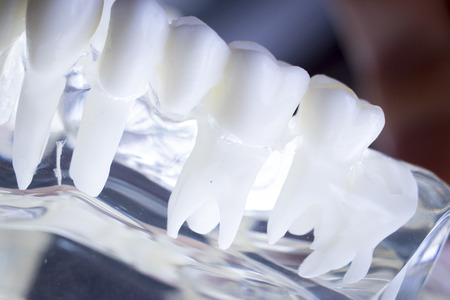 Dentist dental teeth teaching model showing each tooth and gum for patients and students.