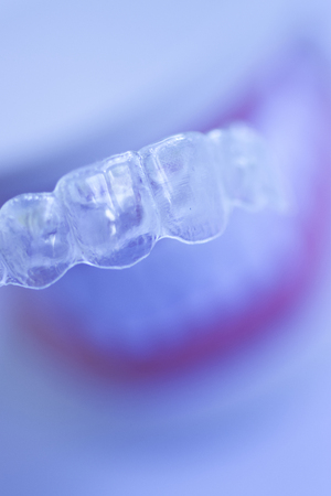 Invisible dental teeth aligners brackets used to align each tooth in cosmetic dentistry for...