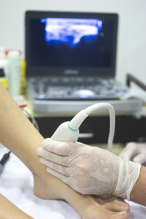 Physiotherapy clinic Intratissue Percutaneous Electrolysis EPI dry needling physiotherapist patient injury.の写真素材