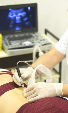 Physiotherapy clinic Intratissue Percutaneous Electrolysis EPI dry needling physiotherapist patient injury.の写真素材