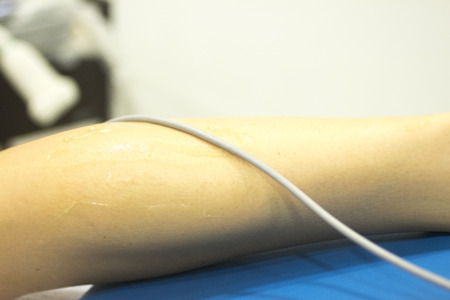 Physiotherapy clinic Intratissue Percutaneous Electrolysis EPI dry needling physiotherapist patient injury.の写真素材