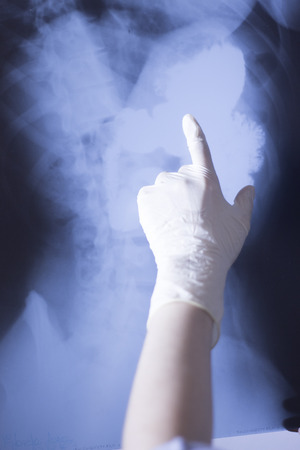 Medical hospital x-ray lowe back pain spine and hips traumatology scan also showing stomach and organs.の写真素材