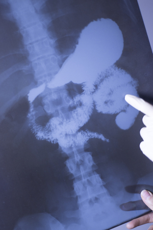 Medical hospital x-ray lowe back pain spine and hips traumatology scan also showing stomach and...