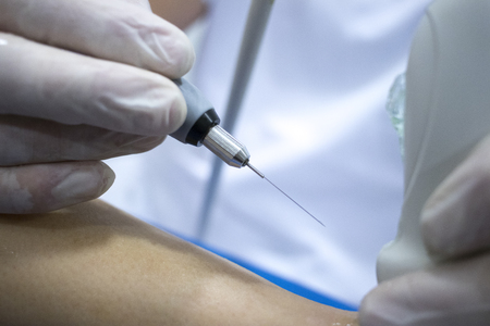 Physiotherapy clinic Intratissue Percutaneous Electrolysis EPI dry needling physiotherapist patient injury.の写真素材