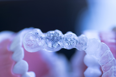 Invisible dental teeth aligners brackets used to align each tooth in cosmetic dentistry for...