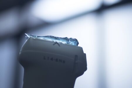 EPI Intratissue Percutaneous Electrolysis dry needling ultrasound ecography scan  physiotherapy medical treatment.の写真素材