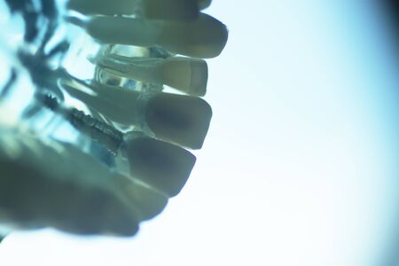 Dental tooth teaching model showing prosthetic teeth and gums