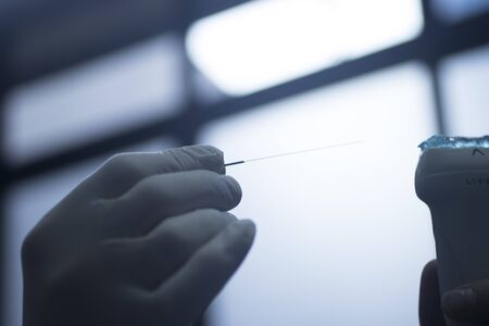 EPI Intratissue Percutaneous Electrolysis dry needling ultrasound ecography scan  physiotherapy medical treatment.の写真素材