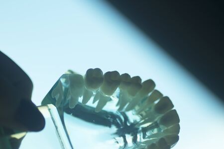 Dental tooth teaching model showing prosthetic teeth and gums