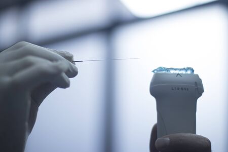 EPI Intratissue Percutaneous Electrolysis dry needling ultrasound ecography scan  physiotherapy medical treatment.の写真素材