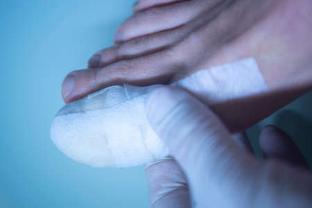 Foot big toe bandage injured feet in medical clinic hospital center.の写真素材