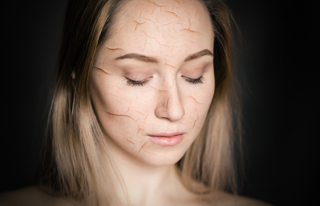 Woman with cracked skin as a cosmetic and dehydration effect concept.