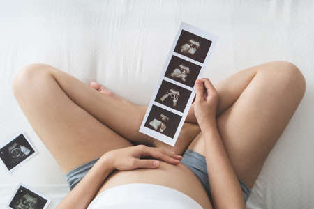 High angle view, Happy Asian Pregnant woman holding ultrasound picture while touch her belly on bed. Young Mother with sonogram of her unborn baby. Concept of pregnancy, Maternity prenatal care.の写真素材