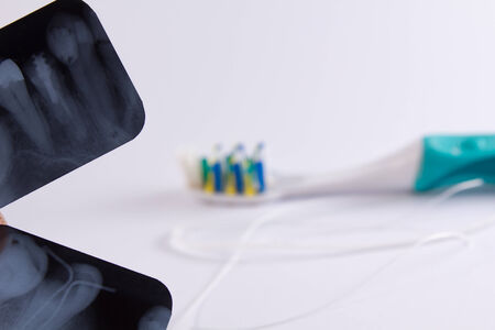 two X-rays with dental floss and toothbrush on white background