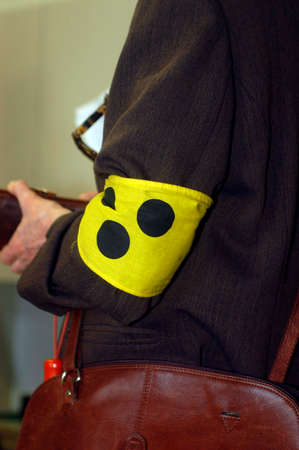 blind loop on a persons left armの写真素材