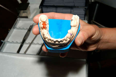 set of teeth at the dentist