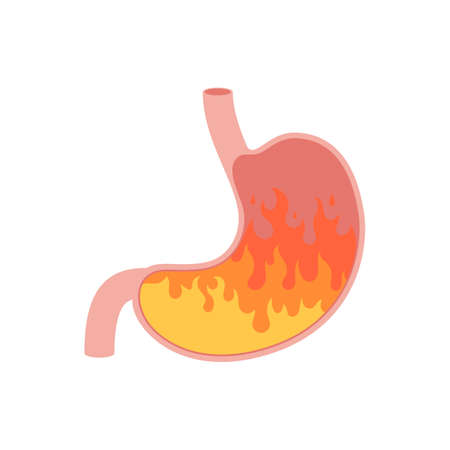 Stomach with fire icon. Human internal organs symbol. Digestive system anatomy. Vector illustration in flat style isolated on white backgroundの写真素材
