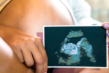 A pregnant girl holds a close-up ultrasound picture of her baby in her hands. The concept of...
