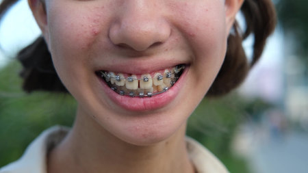 A young teenage girl with braces smiles in nature. Close-up of half of a girls faceの写真素材