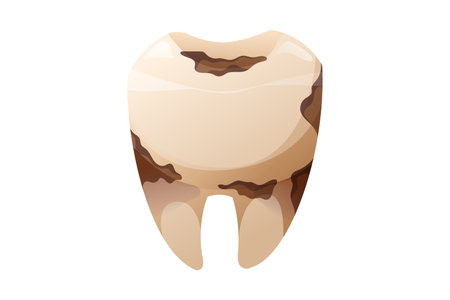 Decayed tooth with cavities and plaque buildup. Damaged molar vector isolated cartoon illustration symbolizing poor oral hygiene, dental problems, and the need for professional treatment.のイラスト素材