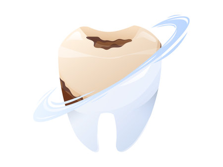 Vector isolated Cartoon illustration of a dirty tooth being cleaned, transforming into a healthy white one with a shiny effect. Concept of dental hygiene, tooth whitening, and oral care.のイラスト素材