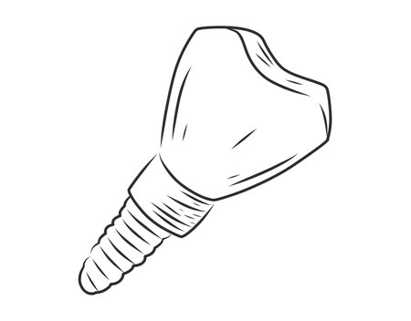 Hand-drawn vector illustration of a dental implant. Black and white sketch of a tooth implant with a screw, representing modern dentistry, oral surgery, and prosthetic dental treatments.のイラスト素材