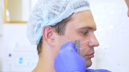 hands of the doctor The cosmetologist makes markings on the face of the man with a pencil. contour face plasticの写真素材