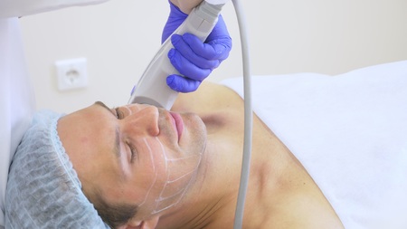 Non-surgical face lifting. SMAS lifting ultrasonic. The process of rejuvenation. Hardware...