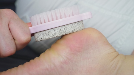 care for dry skin on feet and heels using pedicure pumice tools and a brush.の写真素材