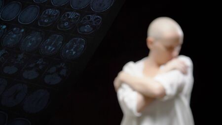 concept Oncological patient, bald woman and doctor man are viewing tomography results on black background.の写真素材