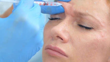 woman takes injections in the face at the reception at the beauticianの写真素材