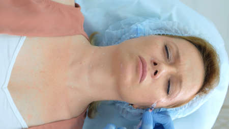 woman takes injections in the face at the reception at the beauticianの写真素材