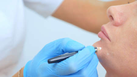 the beautician marks the injection points on the womans face with a pencilの写真素材
