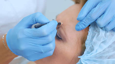 the beautician marks the injection points on the womans face with a pencilの写真素材