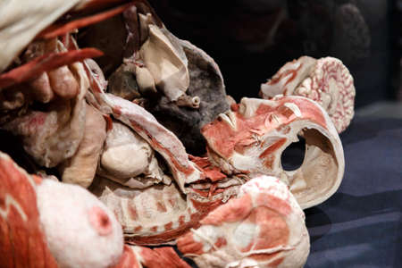 AMSTERDAM, NETHERLANDS - JULY 2, 2016 : Close up detailed view of human body with muscles. Body World is a museum where plastinated bodies are exhibited.のeditorial素材